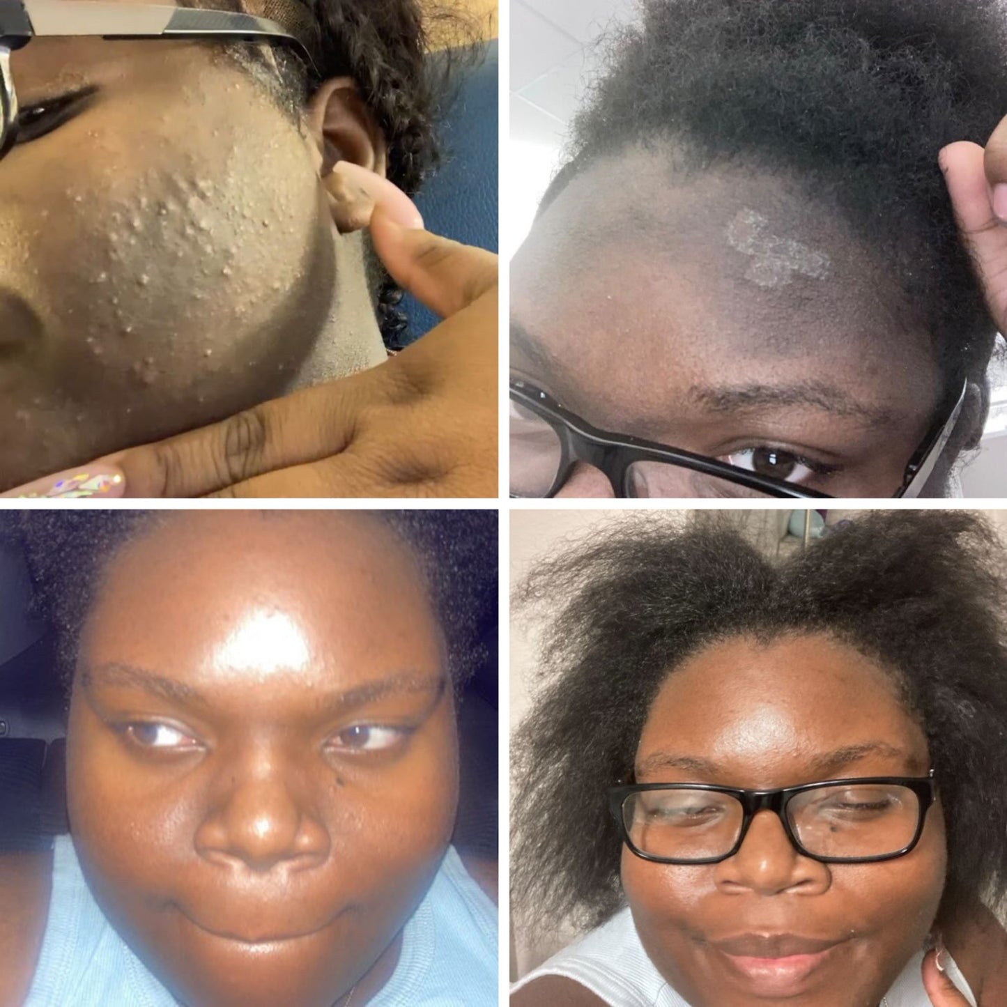 Facial Collection